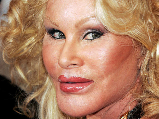 Celebrity plastic surgery disasters