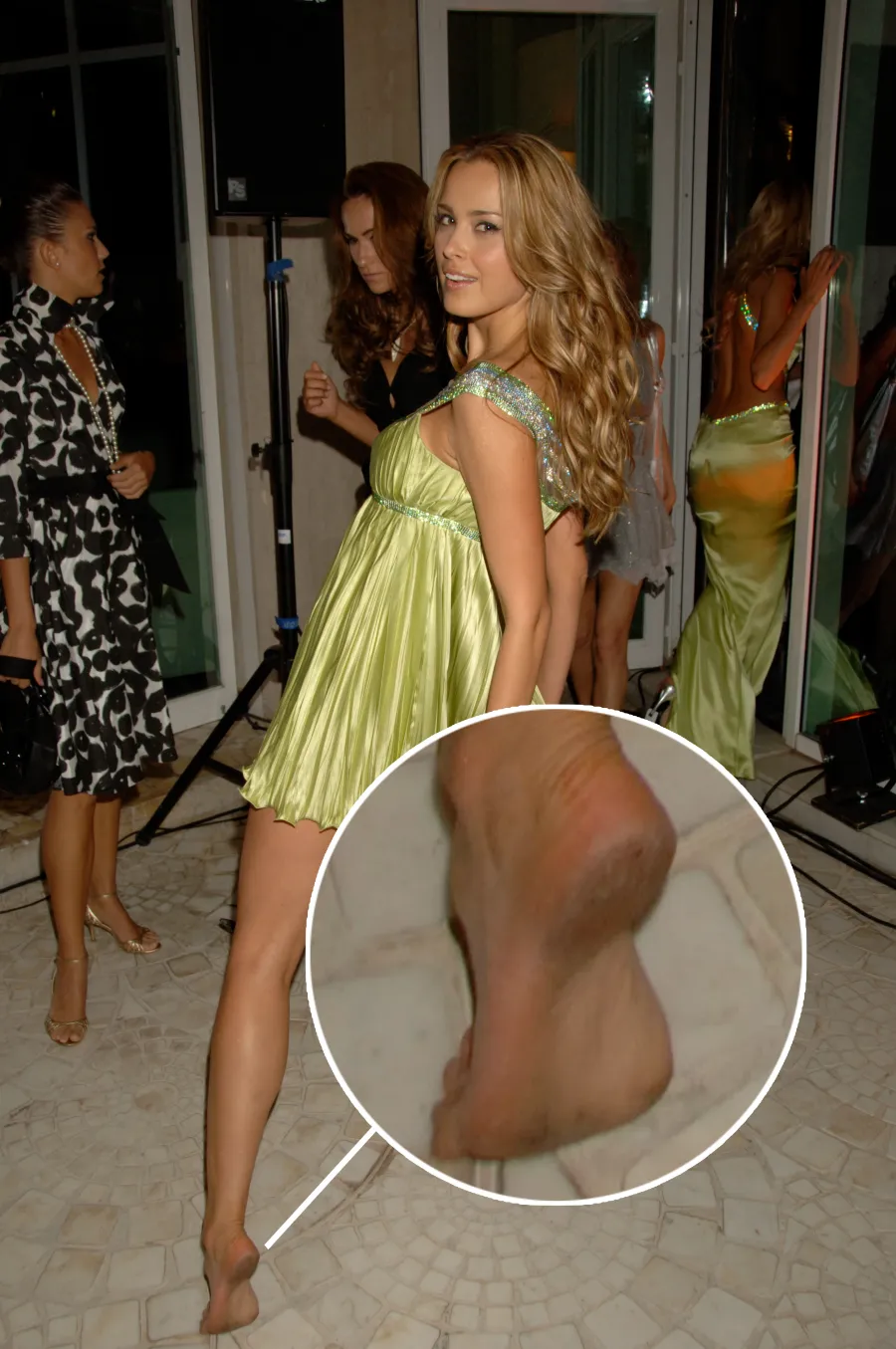 Celebs With Dirty Soles